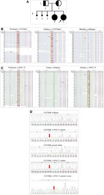 A mosaic mutation in the CLCNKB gene causing Bartter syndrome: A case report